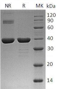 Human CA8/CALS (His tag) recombinant protein