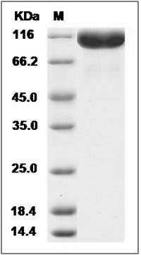 Cynomolgus EWI-F / PTGFRN Protein (His Tag) SDS-PAGE