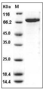 Human CDC42BPB Protein (His & GST Tag) SDS-PAGE