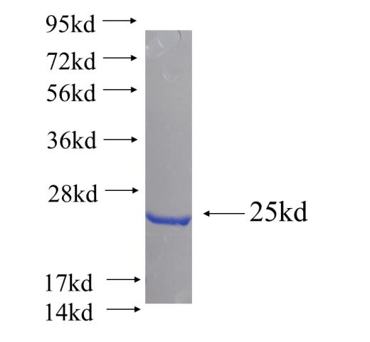Recombinant human GPX8 SDS-PAGE