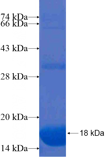 Recombinant Human MOSC2 SDS-PAGE