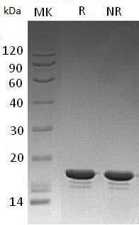 Human STMN1/C1orf215/LAP18/OP18 (His tag) recombinant protein