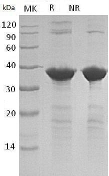 Human TPM1/C15orf13/TMSA (His tag) recombinant protein