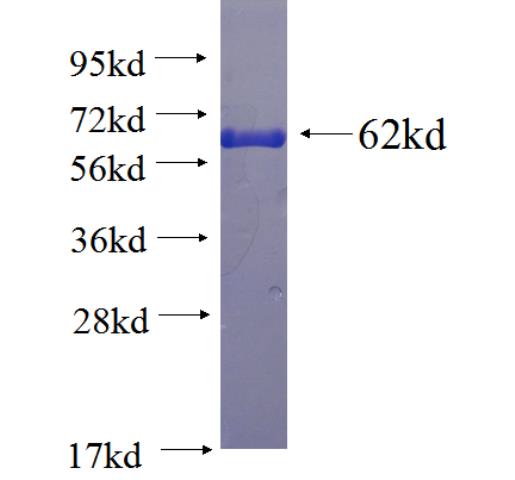 Recombinant human DHRSX SDS-PAGE