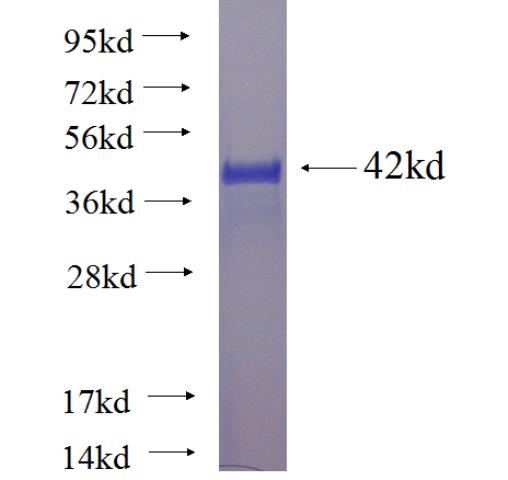 Recombinant human C16orf63 SDS-PAGE