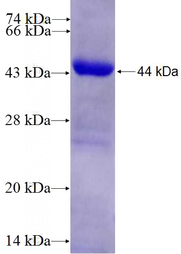 Human ADRBK2 Recombinant protein (6*His tag)