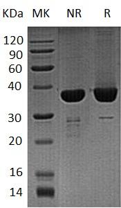 Human DNAJB1/DNAJ1/HDJ1/HSPF1 (His tag) recombinant protein