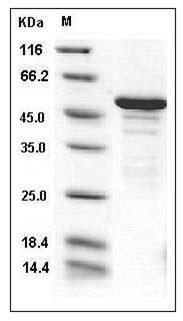 Human ANP32A / PHAP1 Protein (His & GST Tag) SDS-PAGE