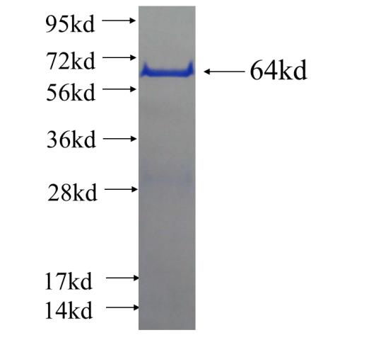 Recombinant human CWF19L2 SDS-PAGE