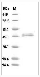 Mouse IGFBP4 Protein (His Tag) SDS-PAGE