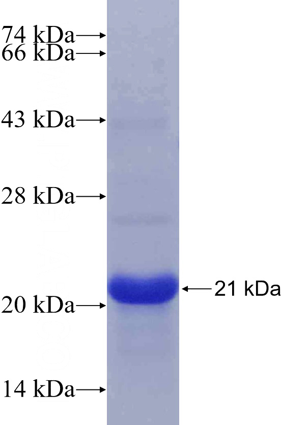 Human LPL Recombinant protein (6*His tag)