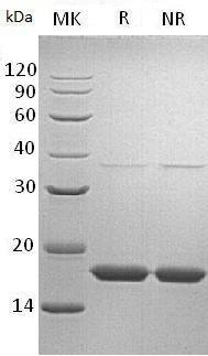 Human TTR/PALB (His tag) recombinant protein