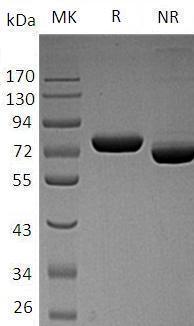 Human POMGNT1/MGAT1.2/UNQ746/PRO1475 (His tag) recombinant protein