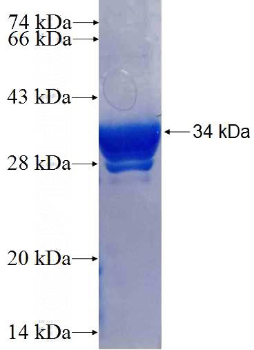 Recombinant Human GNB5 SDS-PAGE