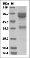 Human LDLRAD3 Protein (Fc Tag) SDS-PAGE