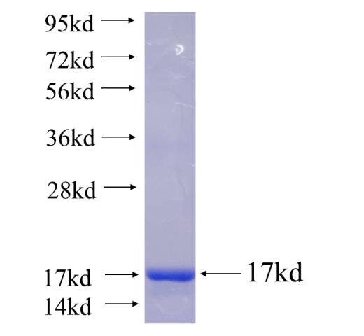 Recombinant human SIKE1 SDS-PAGE