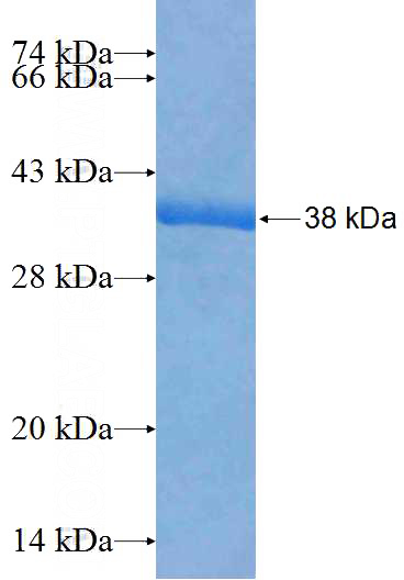 Recombinant Human LYPD2 SDS-PAGE