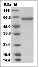 Influenza A H4N4 (A/mallard duck/Alberta/299/1977) Hemagglutinin / HA Protein (His Tag)