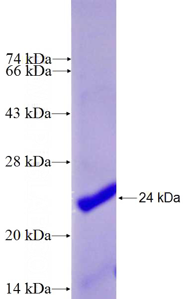 Recombinant Human MYCN SDS-PAGE