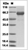 Influenza A H5N1 (A/common magpie/Hong Kong/5052/2007) Hemagglutinin / HA Protein (His Tag)