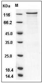 Human PKC nu / PRKD3 Protein (GST Tag) SDS-PAGE