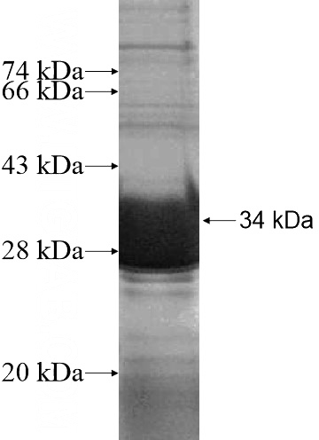Recombinant Human SNTG1 SDS-PAGE
