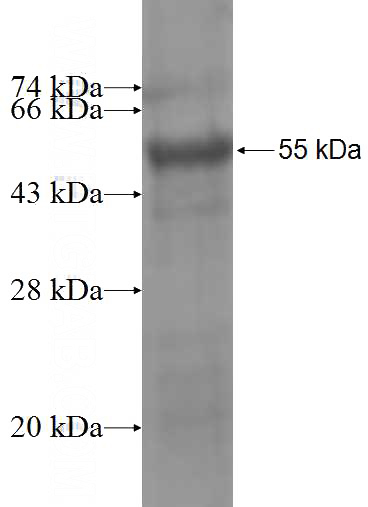 Recombinant Human ST6GALNAC3 SDS-PAGE