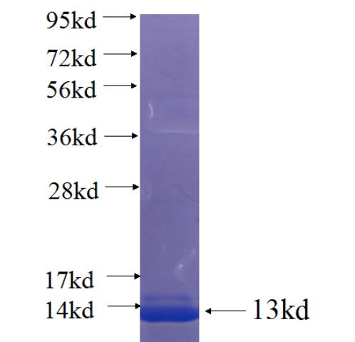 Recombinant human LPPR2 SDS-PAGE