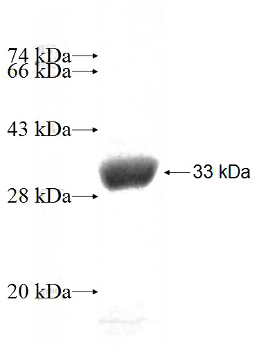 Recombinant Human DHX30 SDS-PAGE