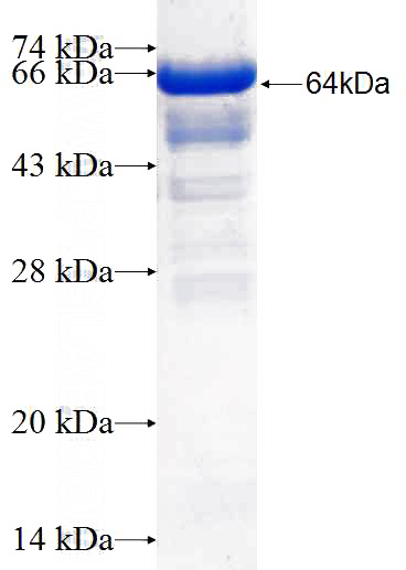 Recombinant Human PUM2 SDS-PAGE