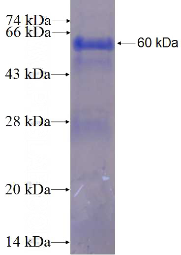 Recombinant Human ORC5L SDS-PAGE