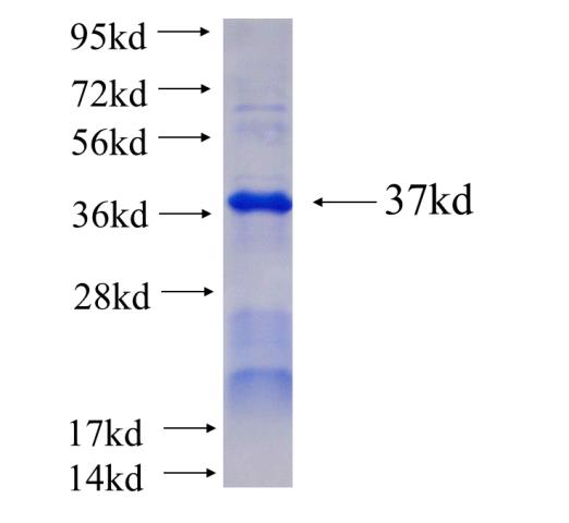 Recombinant human SNX6 SDS-PAGE