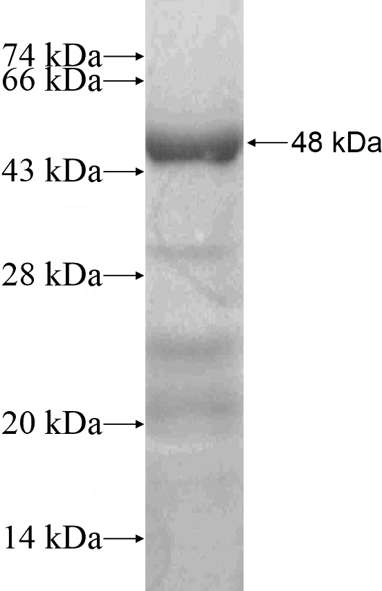 Recombinant Human CCDC67 SDS-PAGE
