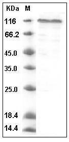 Human COMP Protein (His Tag) SDS-PAGE