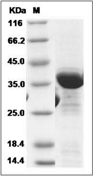 Human GMPR / GMPR1 Protein (His Tag) SDS-PAGE