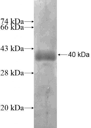 Recombinant Human C10orf119 SDS-PAGE
