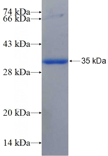 Recombinant Human LRRC59 SDS-PAGE