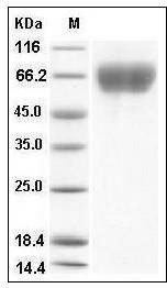 Mouse FGFR3 / CD333 Protein (His Tag) SDS-PAGE
