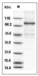 Human ELK1 Protein (His & GST Tag) SDS-PAGE