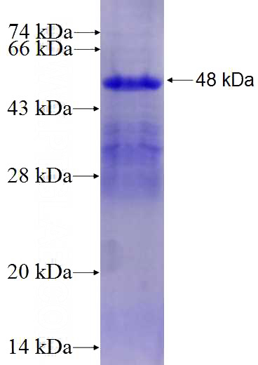 Recombinant Human EDN3 SDS-PAGE