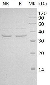 Human MYOZ2/C4orf5 (His tag) recombinant protein
