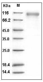 Human SLITRK1 Protein (His Tag) SDS-PAGE