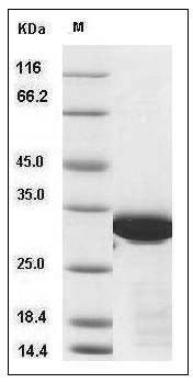 Human BCL6 / B-cell CLL lymphoma 6 Protein (aa 1-150, His & Trx Tag) SDS-PAGE