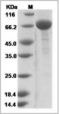 Mouse IL17BR / IL17RB / IL-17 Receptor B Protein (Fc Tag)