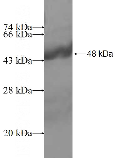Recombinant Human ORM1 SDS-PAGE