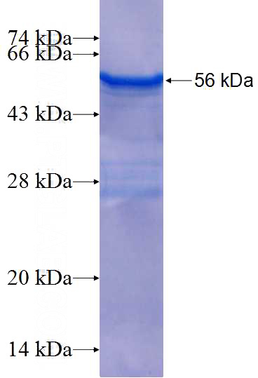 Recombinant Human MCF2L SDS-PAGE