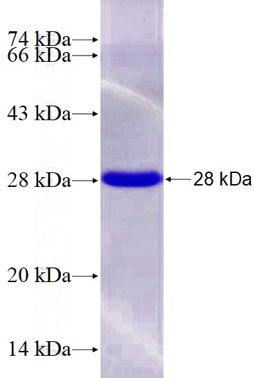 Recombinant Human C11orf35 SDS-PAGE