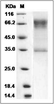 Human CLM-9 / TREM4 / CD300LG Protein (Fc Tag) SDS-PAGE