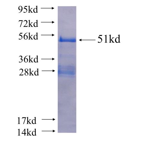 Recombinant human CUEDC2 SDS-PAGE