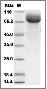 Rat HepaCAM2 Protein (Fc Tag) SDS-PAGE